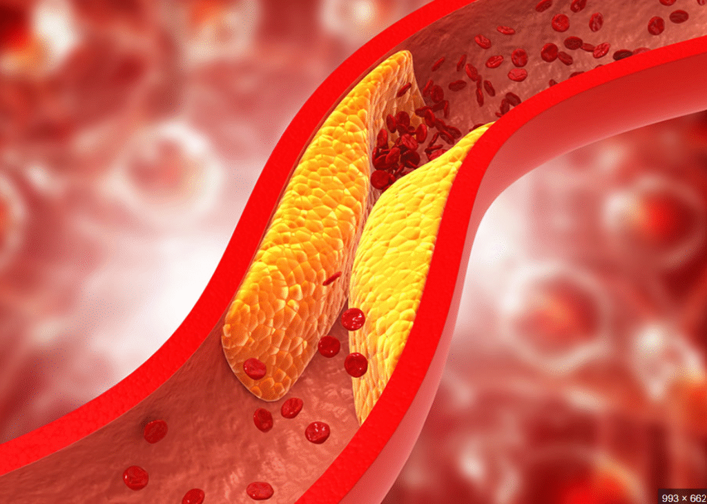 Zespół metaboliczny — patofizjologia, objawy i kierunki terapii